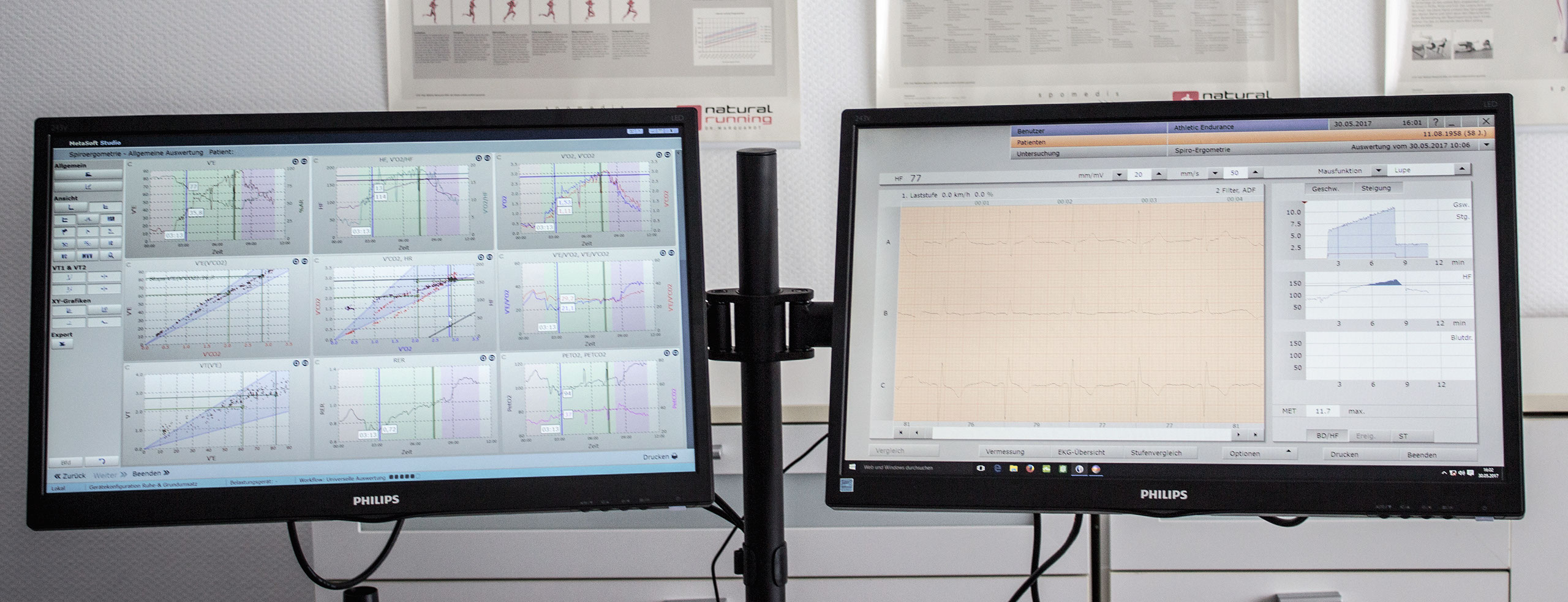 Diashow Leistungsdiagnostik, Grundumsatzmessung, Stoffwechselanalyse, Personaltraining